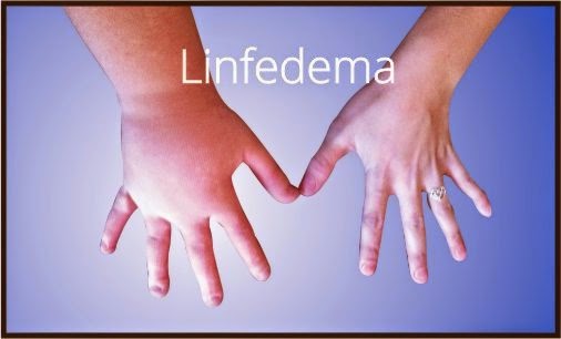 Il linfedema e i trattamenti